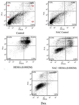 N-Acetylcysteine Protects the Stem Cells of the Apical Papilla